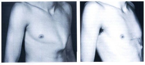  تصویر 2. فتوگرافی قبل و بعد از عمل بیمار PC